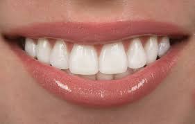 teeth whitening at home