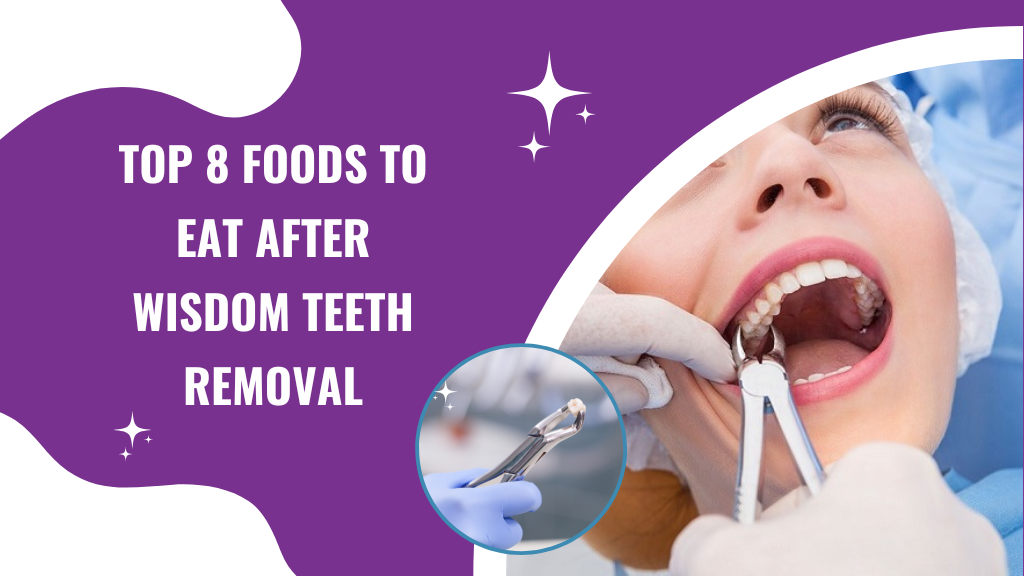 Top 8 foods to eat after wisdom teeth removal- banner.